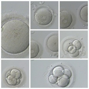 40767153 - human ivf