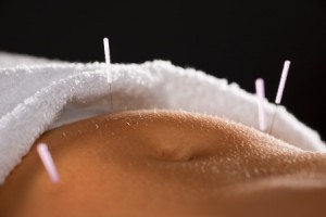 4540703 - close-up of acupuncture needles on belly - selective focus
